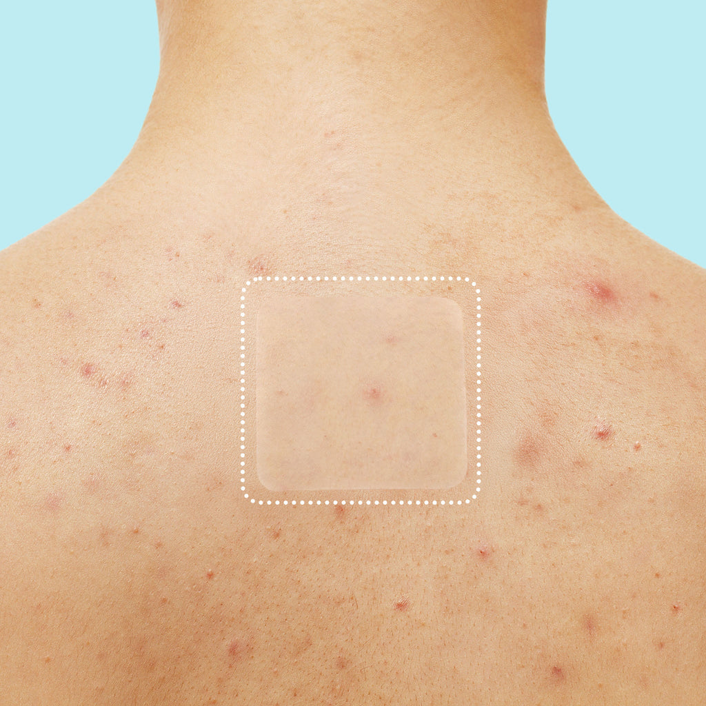 Miracle Patch XL Spot Control Cover