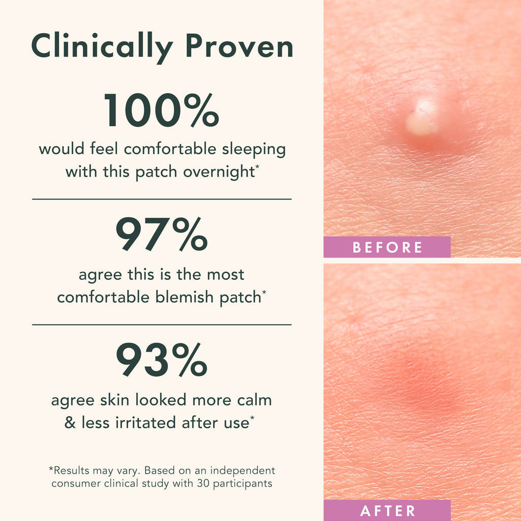 Miracle Patch Overnight Spot Cover